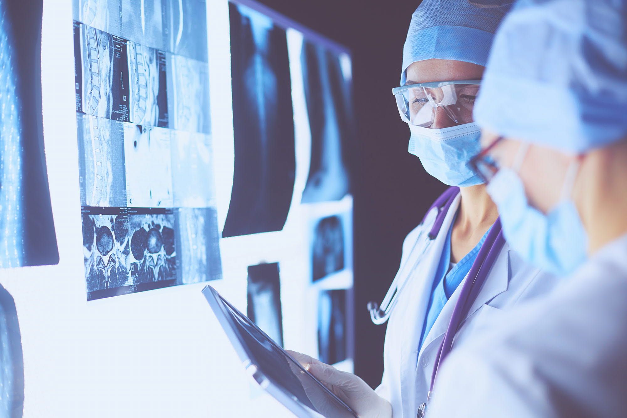 2 female doctors reviewing X-rays