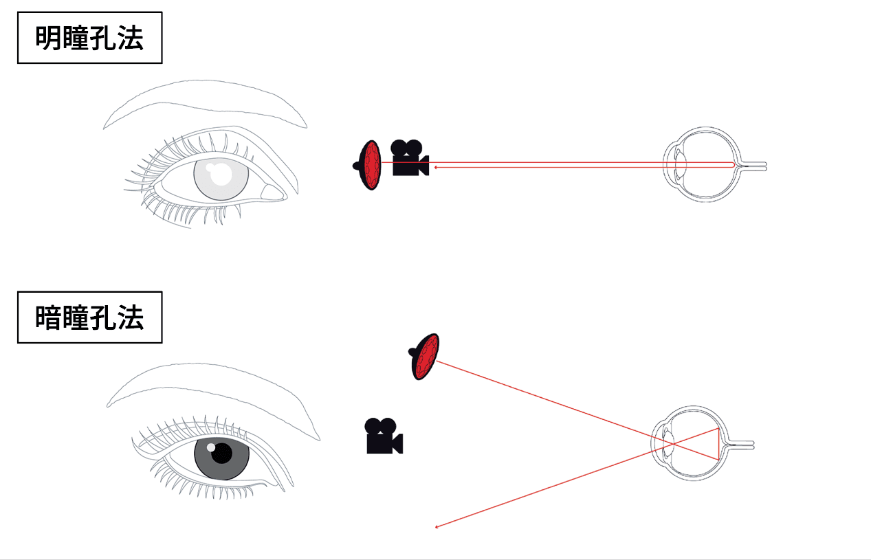 explain about bright pupil effect and dark pupil effect