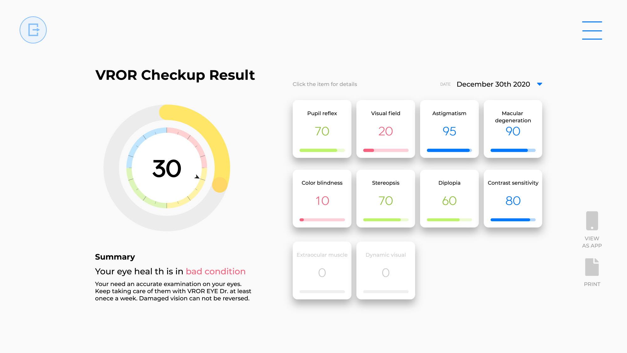 Tobii VROR check up results